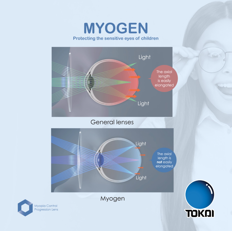 Tokai Myogen Lenses in Pakistan